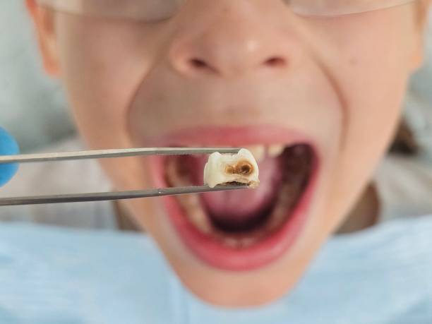 Best Pediatric Emergency Dentist in Koloa, HI