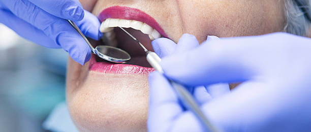 Best Emergency Dentist for Knocked-Out Tooth in Koloa, HI